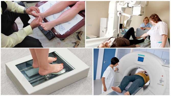 Диагностика полой стопы