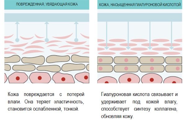 Фонофорез лица с гидрокортизоном, карипаином, гиалуроновой кислотой. Показания и противопоказания, аппараты для ультразвуковой процедуры