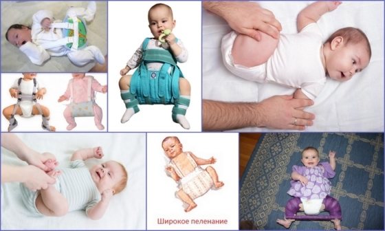 Гимнастика для грудничков при дисплазии тазобедренных суставов