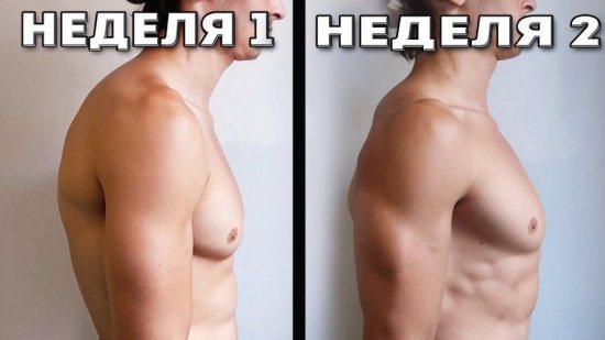 Гимнастика при кифозе