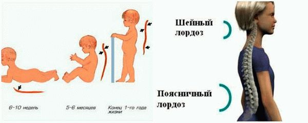 Грудной кифоз возникает у ребенка в возрасте __ мес.
