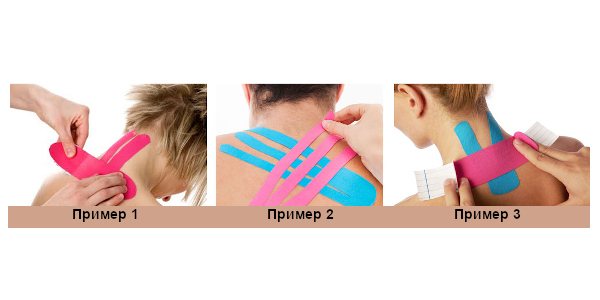 Инструкция по накладыванию