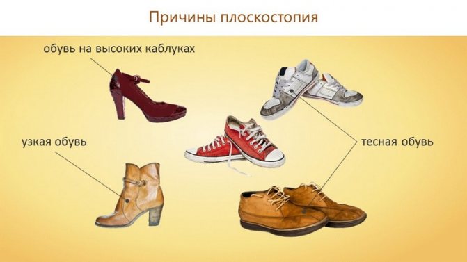 Какую обувь носить при плоскостопии
