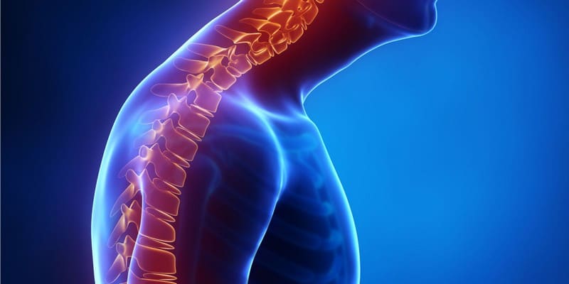 Кифоз и армия