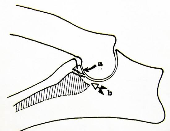 Лечение остеохондроза у собак