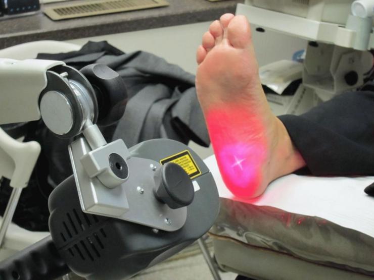 Лечение пяточной шпоры йодом