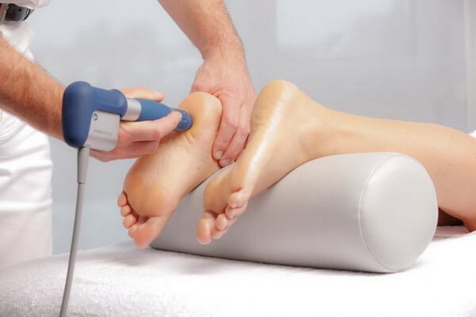 Лечение пяточной шпоры УВТ: преимущества процедуры