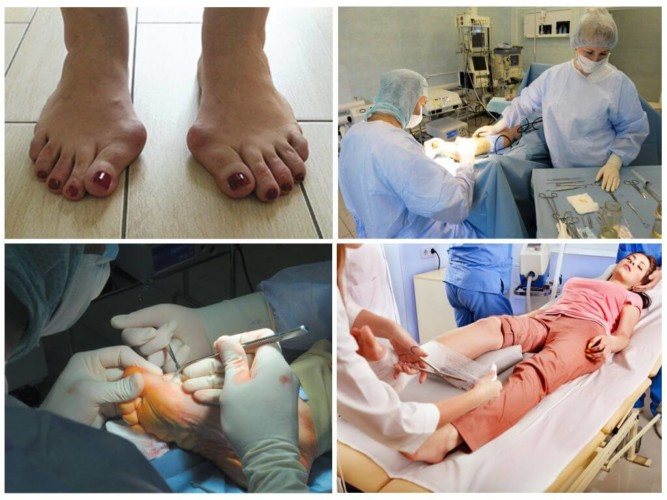 Лечение суставовКто лечит подагру из врачей