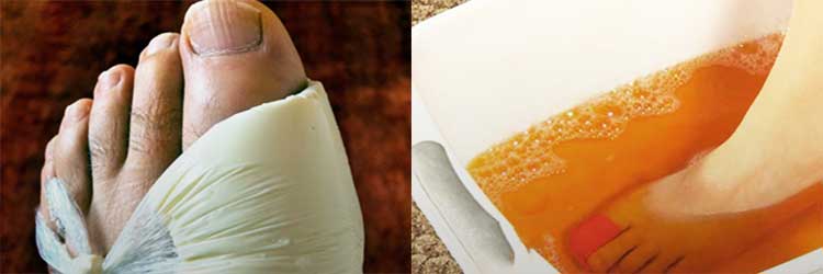 Лечение суставовКто лечит подагру из врачей