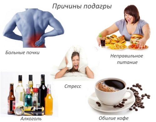 Лечение суставовКто лечит подагру из врачей