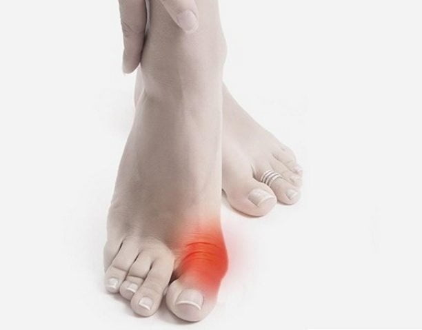 Лекарство от подагры: таблетки, мази, уколы, список препаратов