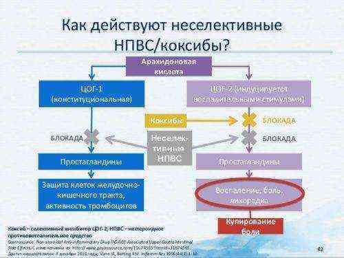 нпвп при артрозе