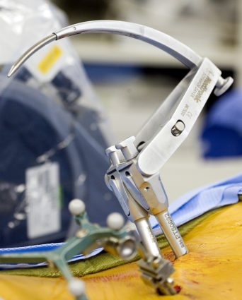 Операция по удалению грыжи