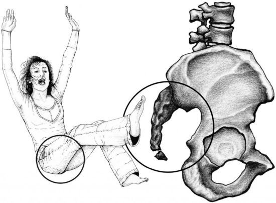 Падение на копчик