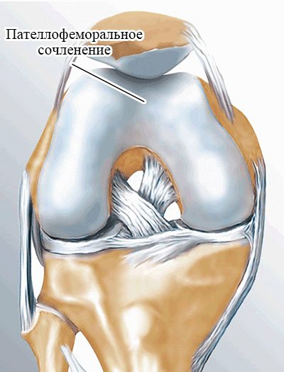 пателлофеморальное сочленение