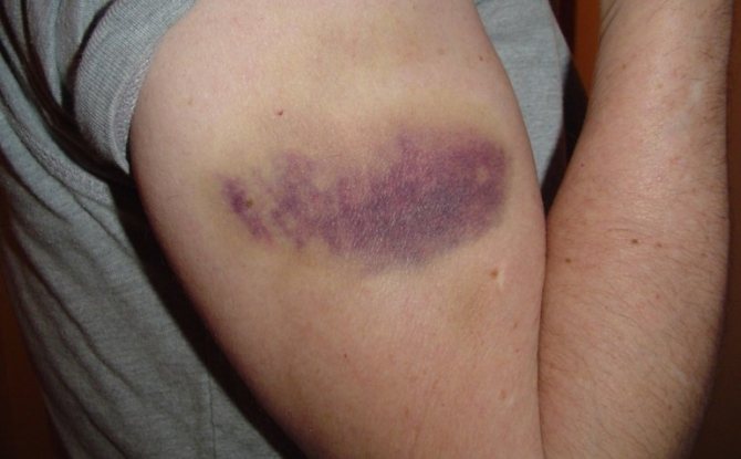 Показания и инструкция к применению