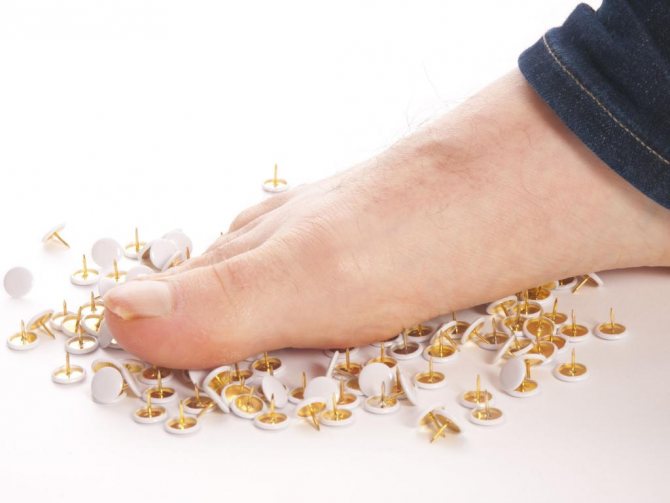 Полинейропатия верхних и нижних конечностей симптомы лечение