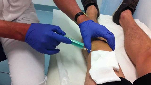 пункция коленного сустава