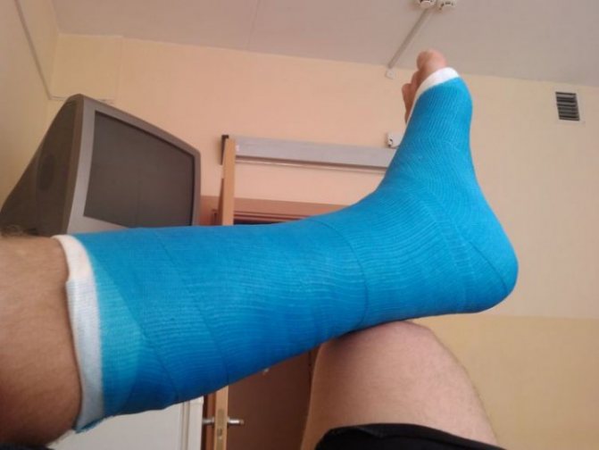 Реабилитация после перелома голеностопа