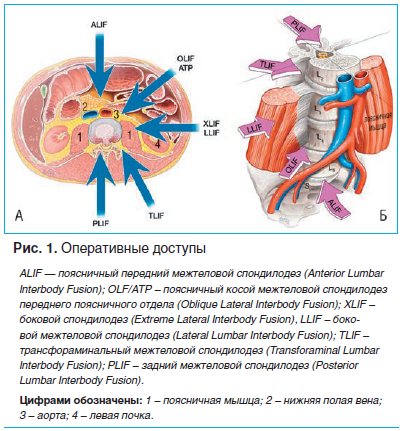 Рис. 1. Оперативные доступы