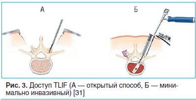 Рис. 3. Доступ TLIF