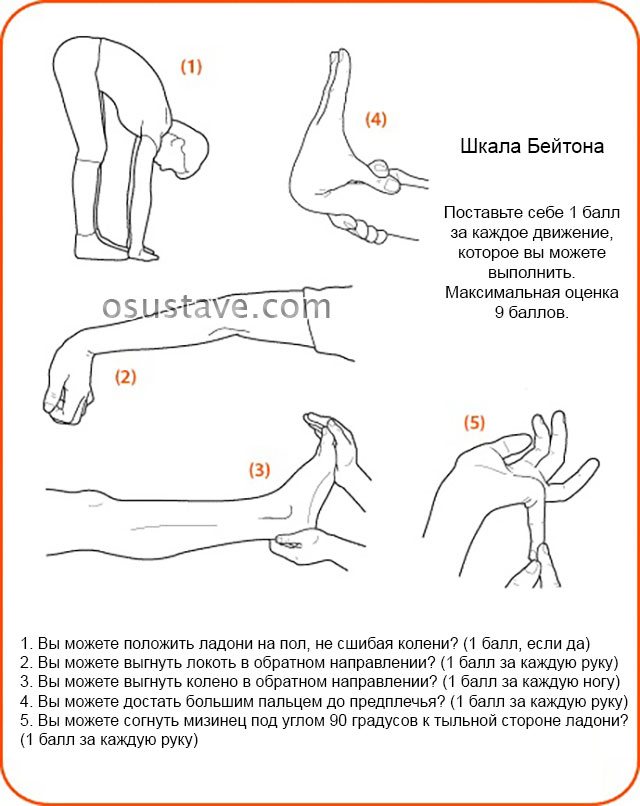 шкала Бейтона