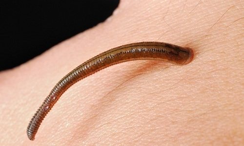 Слюна пиявок способствует нормализации кровоснабжения на пораженном участке и обмена веществ