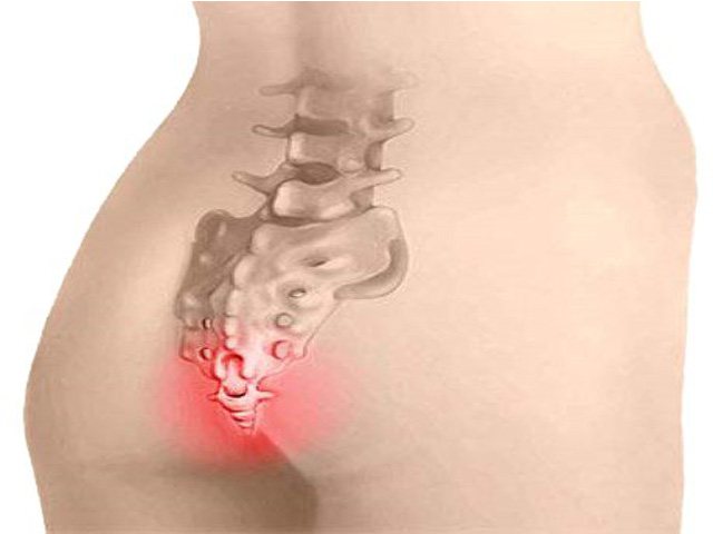 Травмированный копчик