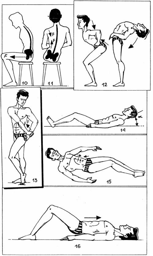 Упражнения, эффективные при остром хондрозе