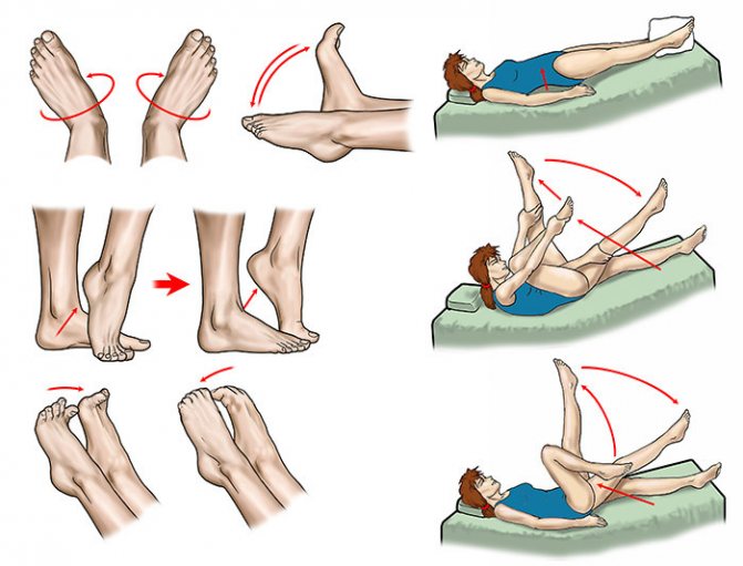 Упражнения после перелома для голеностопа: перечень для реабилитации