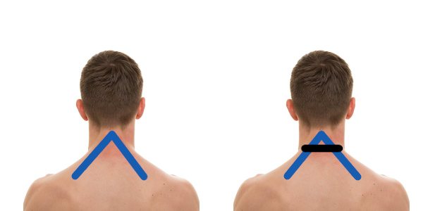 Важные моменты тейпирования