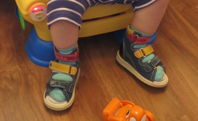 Выбор ортопедических стелек для детей