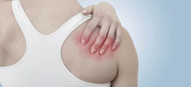 вывих плеча